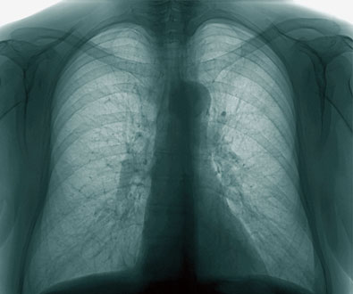 Mummified Remains Yield 14 TB Strains
